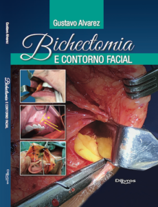 Bichectomia 3 bichectomia livro técnica gustavo alvarez