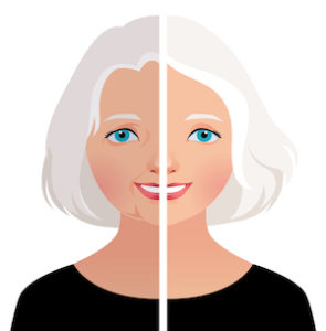 lifting facial ou cirurgia plástica do rosto recuperação