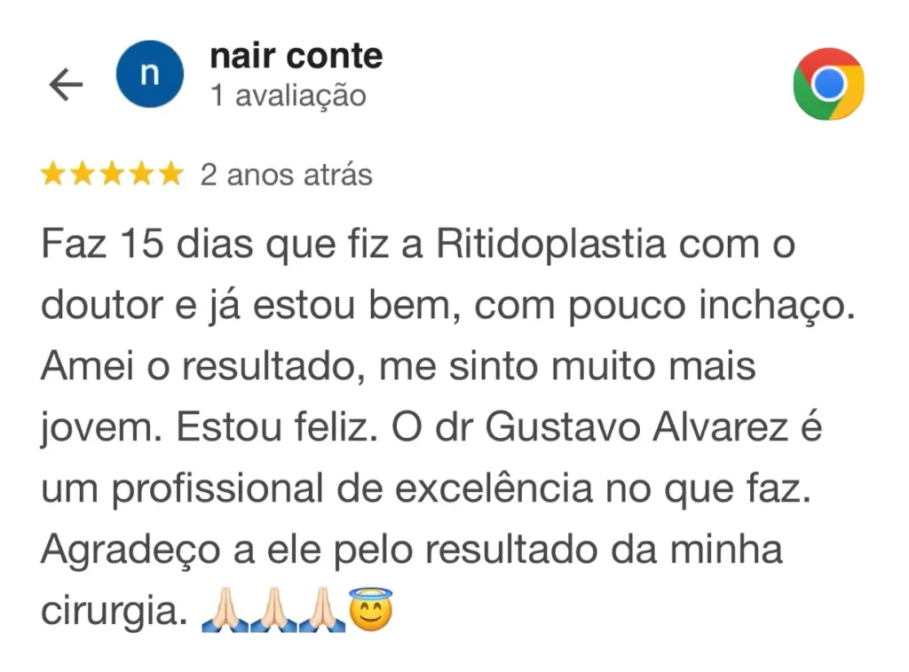 depoimento-antes-e-depois-lifting-facial-deep-plane-gustavo-alvarez-cirurgiao-plastico-3