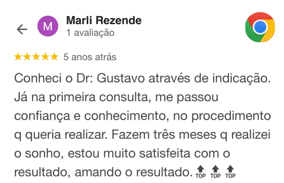 depoimento-antes-e-depois-lifting-facial-deep-plane-gustavo-alvarez-cirurgiao-plastico-6