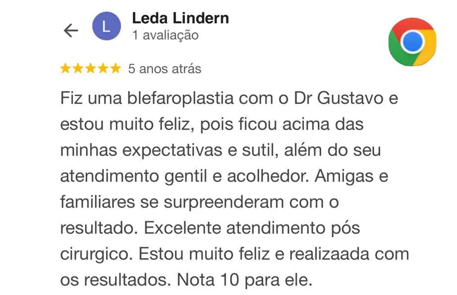 depoimento-antes-e-depois-lifting-facial-deep-plane-gustavo-alvarez-cirurgiao-plastico-7